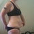 Photos taken day before surgery.