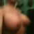 Semi side view in motion, in the buff post-op. 44 days out