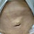 Lumpy stomach when garment comes off