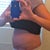 PO Day 12 - Swollen and fat - Look at that gut!!!  Where is my flat tummy I was supposed to have?  :-(