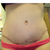 up close trying to find the picture of extra skin but husband put it up cant find it