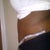 12 days post op