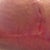 Underside of my left breast where the incision opened up. Doc says it's probably a stitch working it's way out. Post op one month