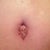 PO 4 wks 2 days. BB looking better
