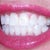 I really did not want to still be wearing them 1-1/2 yrs, but I am. The right bottom teeth are misaligned.