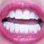 And I'd like to note that I want bonding done to make each tooth look sculpted, and you have to be certain your dentist is artistic, cause some are not at all.