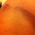 Right Drain hole that reopened is healing just like the left now