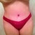 4 weeks post op