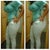 Plastic surgery app close to how big I wnt it to look
