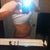 1.5 months post op