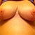 This pic was taken 2-15, almost 60 days post op.