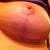 Taken 2-15, close up of left breast. almost 60 days post op