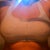 1 week and 2 days after surgery with zip up sorts bra