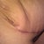 Loose skin on the right side.