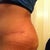 He would extend the incision about 3-4 inches I think and lift from the bottom and pull from the top.