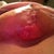 here you can see the white dots...new tissue. (sorry for it being upside down I couldn't fix it)