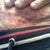 Week 8 - bumps below scar that showed up yesterday. From what I read, it's sutures coming to the surface. Tender to the touch!