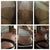 Before & After @ 5 weeks PostOp