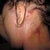 neck lift area