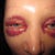 upper and lower eyes