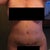 Please note the scar across my abdomen is from a tummy tuck in 2002