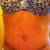 20 days post op!