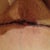 Close up of incision. Tape will come off next week