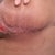 Left Breast 1/13/2013