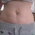 William Bruno, MD answers: Would a Mini Tummy Tuck be enough for me?