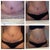 Scar progression wk 7