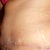 23 days left side view