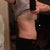 1.5 weeks after sides.  5 weeks after upper stomach. Line is pretty much gone, and now my lower stomach looks huge in comparison!