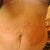 Sorry picture not that great so hard taking one of your tummy on the phone, disgusting can't wait till it goes x