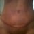 Tummy scar( so swollen) 4 weeks