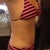 14wk left side