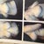 Photos the doctor took.
