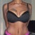 5 weeks post op