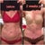 I love comparison pictures- good reminder of what was-2 weeks po