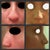 Before and After---it's easier to notice the difference this way :]
