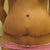 2 weeks PO close-up