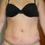 Post Op Day 2- Front View