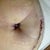 Close up of belly button
