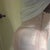 One day post op
