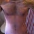 Post Op - Day 23 - After my second PO visit and with silicone tape.