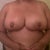 And here are my new buddies. Swollen, leaky, and lifted. Whoop whoop.