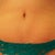 8/7 
1 month 2 weeks po
Tummy looks a bit wrinkly in these pics becuase I had my compression garment on all day