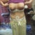 5 Days post op, lots of swelling, especially around the hips!