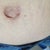 Belly button from my view. Really, all this is better than some loose skin and stretch marks?