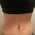 3 Weeks post op in the morning.  I get rounder as the day progresses.