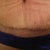 3 Week Incision, I hope it looks normal?